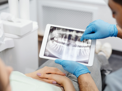 about-us-lawrence-park-dental-xray